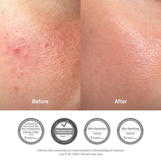 345 Relief Cream | Lightweight Barrier Moisturizer